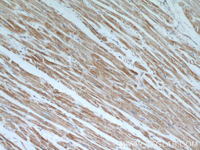 Prohibitin Antibody in Immunohistochemistry (Paraffin) (IHC (P))