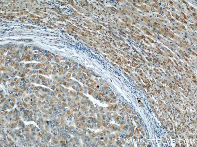 Prohibitin Antibody in Immunohistochemistry (Paraffin) (IHC (P))