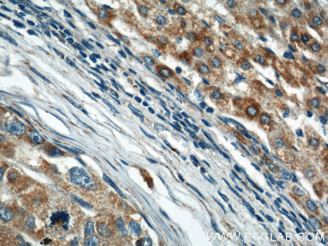 Prohibitin Antibody in Immunohistochemistry (Paraffin) (IHC (P))