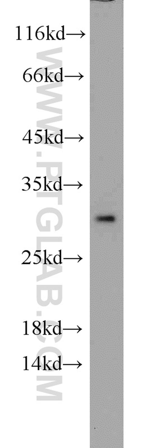 Prohibitin Antibody in Western Blot (WB)