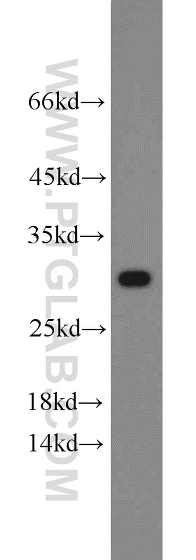 Prohibitin Antibody in Western Blot (WB)