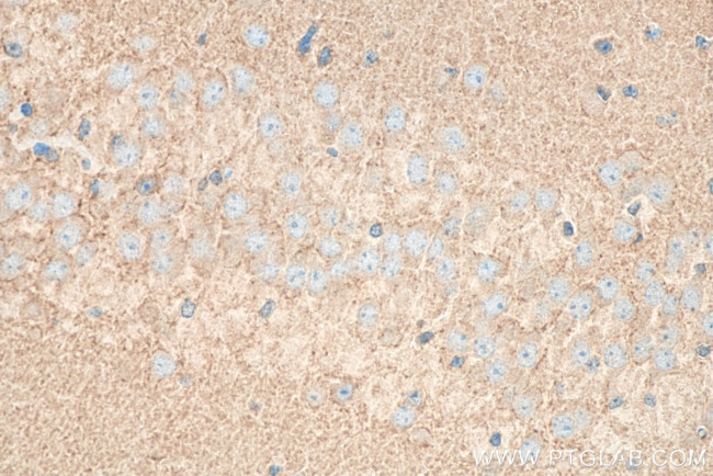 RAB3C Antibody in Immunohistochemistry (Paraffin) (IHC (P))