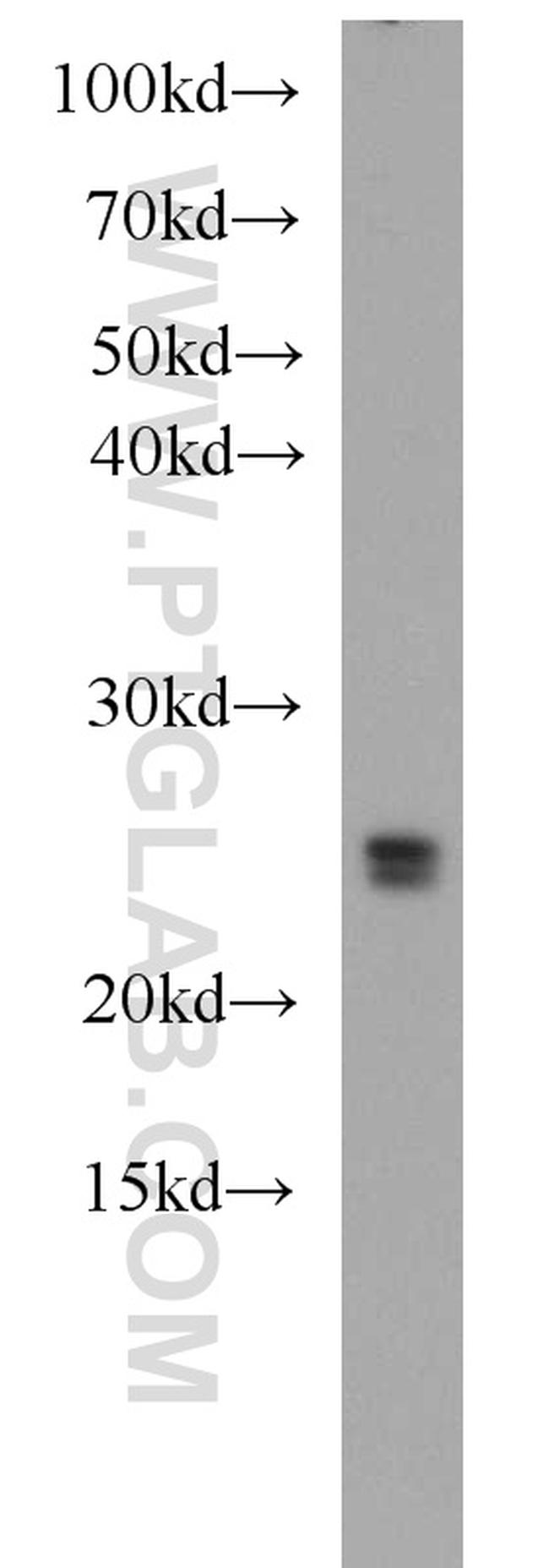 RAB3C Antibody in Western Blot (WB)