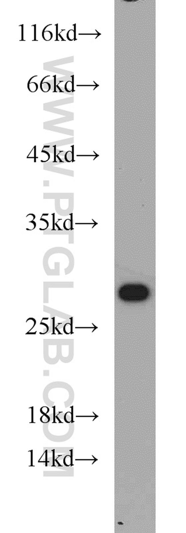 RAB3C Antibody in Western Blot (WB)