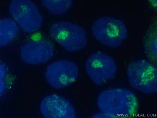 ARF1 Antibody in Immunocytochemistry (ICC/IF)