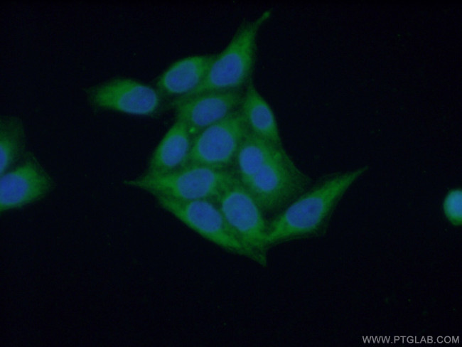 ARF1 Antibody in Immunocytochemistry (ICC/IF)