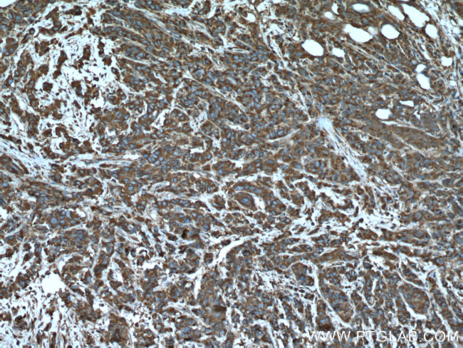 ARF1 Antibody in Immunohistochemistry (Paraffin) (IHC (P))