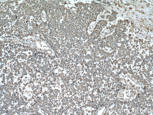 ARF1 Antibody in Immunohistochemistry (Paraffin) (IHC (P))