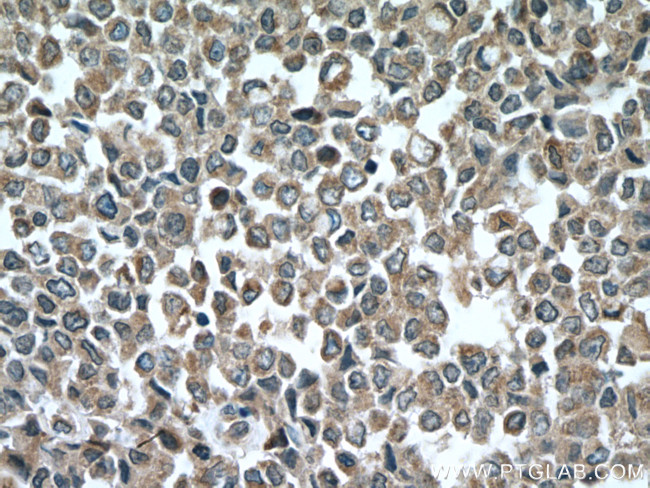 ARF1 Antibody in Immunohistochemistry (Paraffin) (IHC (P))