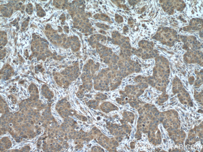 ARF1 Antibody in Immunohistochemistry (Paraffin) (IHC (P))