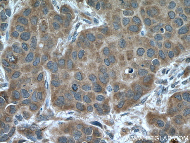 ARF1 Antibody in Immunohistochemistry (Paraffin) (IHC (P))