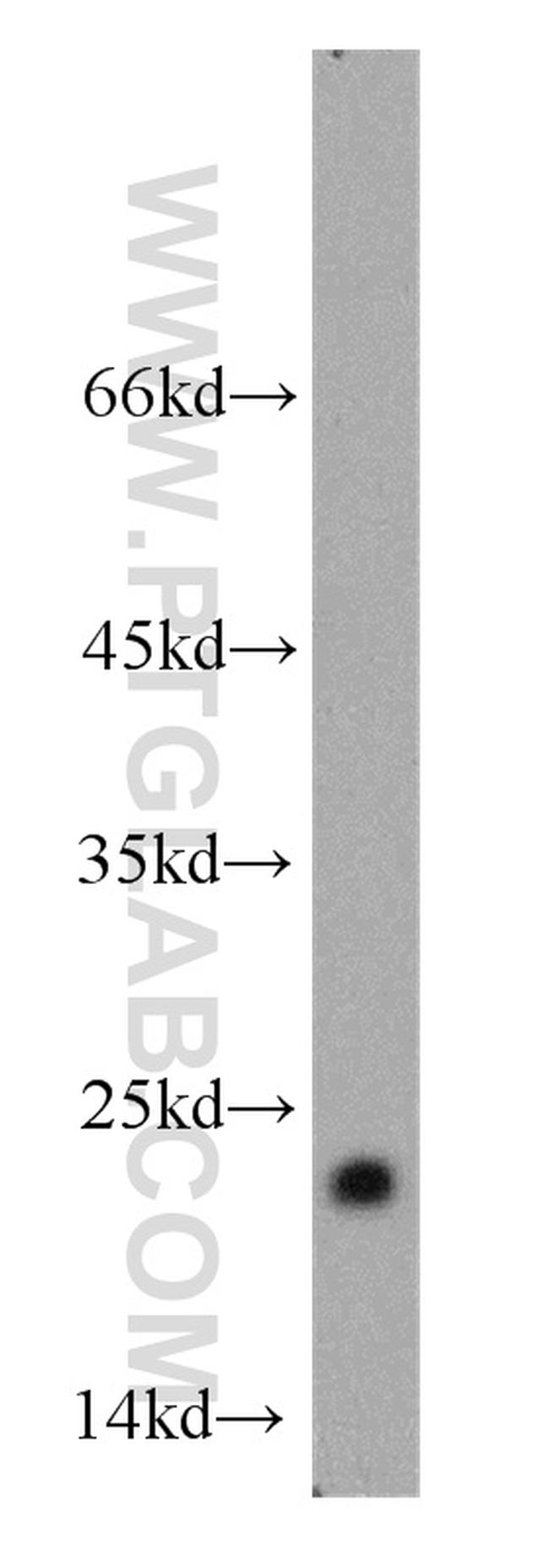 ARF1 Antibody in Western Blot (WB)