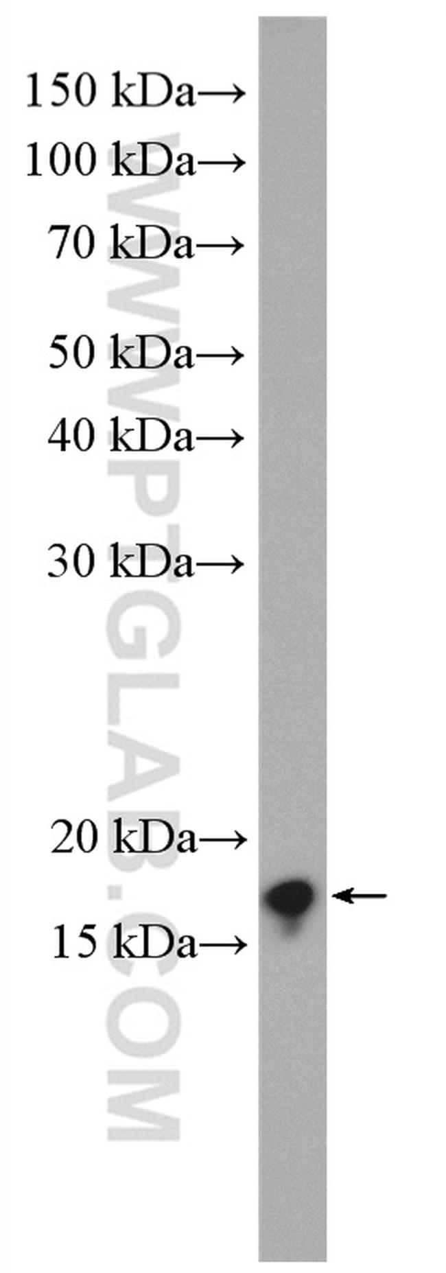 ARF1 Antibody in Western Blot (WB)