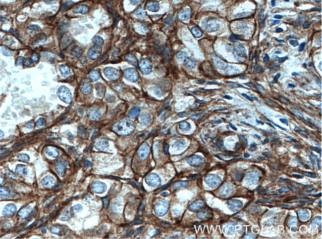 Alpha adducin Antibody in Immunohistochemistry (Paraffin) (IHC (P))