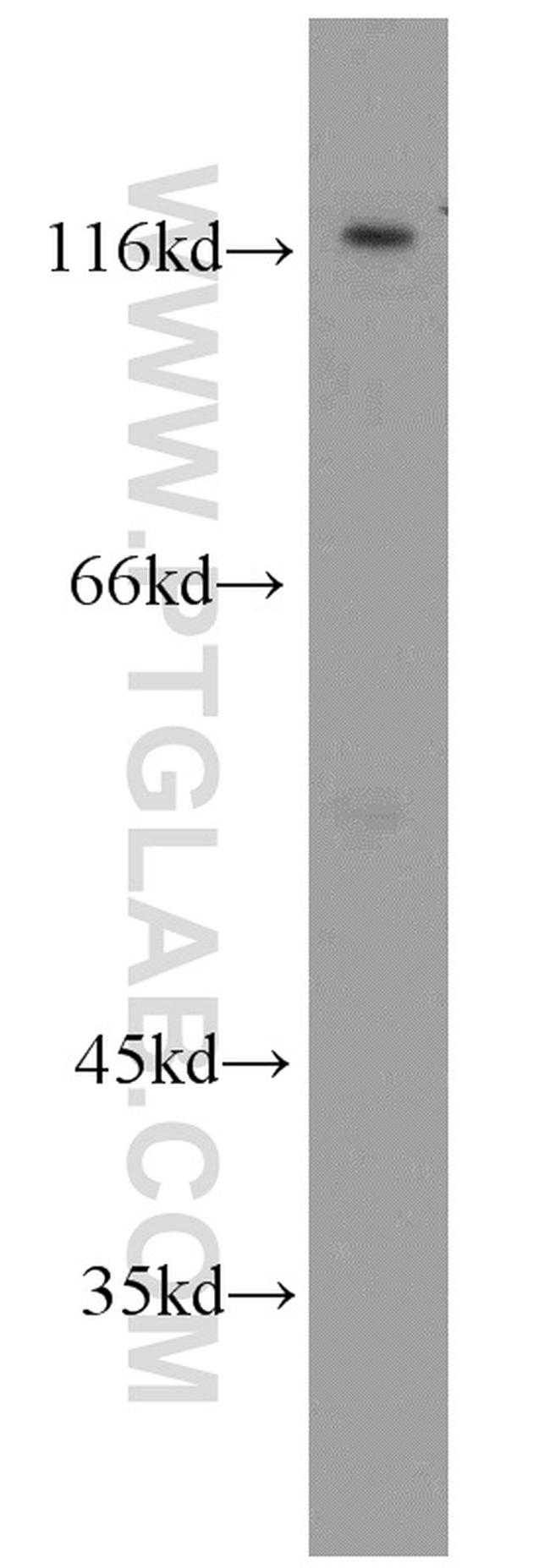 Alpha adducin Antibody in Western Blot (WB)