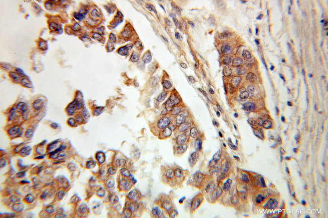 Alpha adducin Antibody in Immunohistochemistry (Paraffin) (IHC (P))