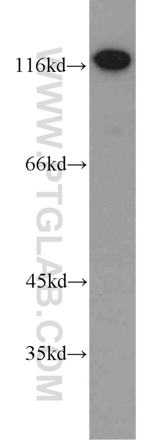 Alpha adducin Antibody in Western Blot (WB)