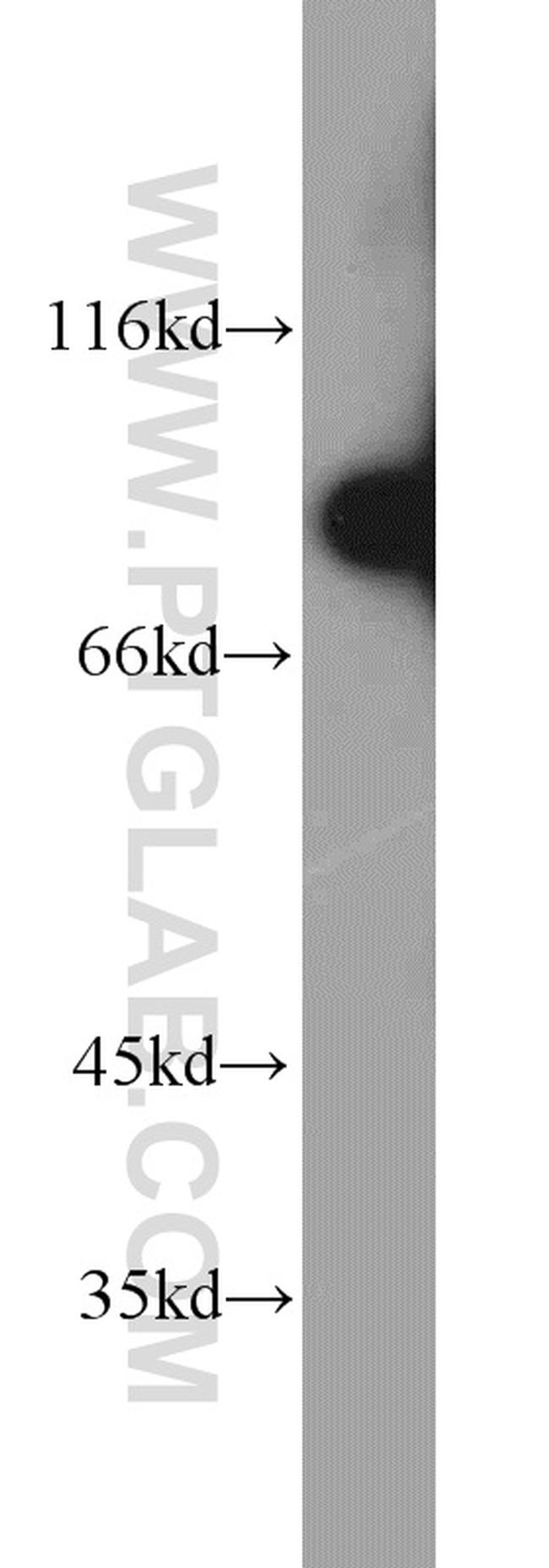 REC8 Antibody in Western Blot (WB)