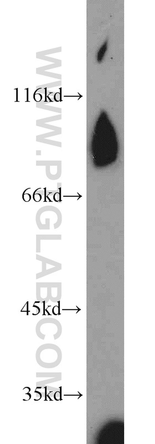 REC8 Antibody in Western Blot (WB)