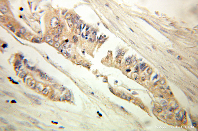 MTHFD1 Antibody in Immunohistochemistry (Paraffin) (IHC (P))