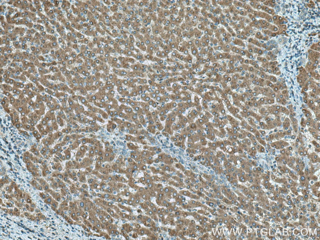 MTHFD1 Antibody in Immunohistochemistry (Paraffin) (IHC (P))