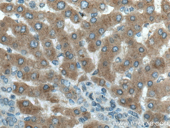 MTHFD1 Antibody in Immunohistochemistry (Paraffin) (IHC (P))