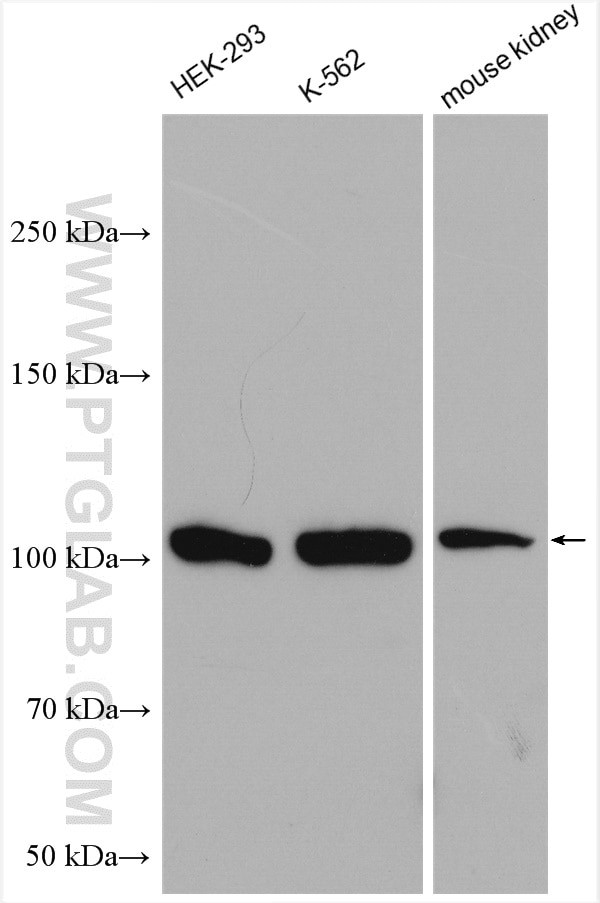 MTHFD1 Antibody in Western Blot (WB)