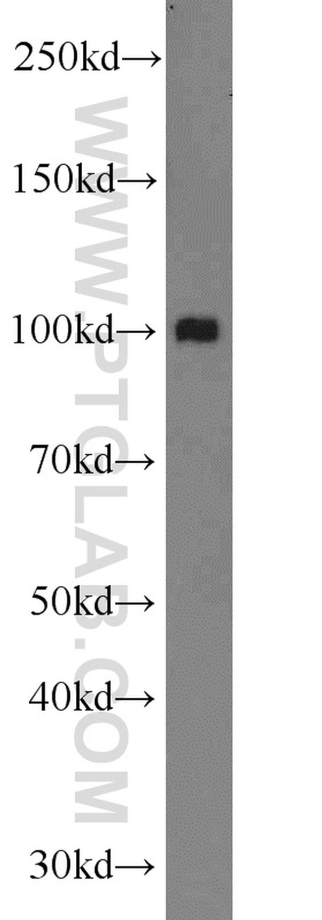 MTHFD1 Antibody in Western Blot (WB)