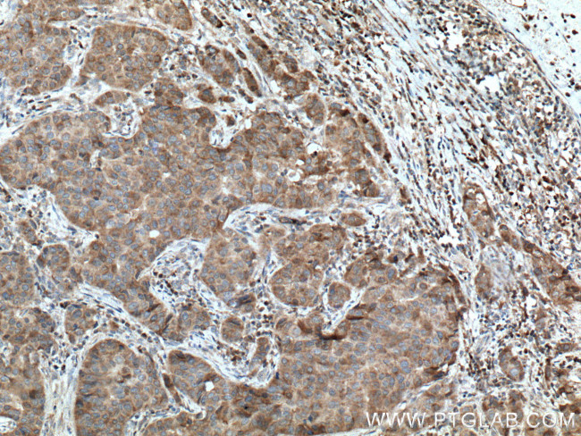 Sestrin 2 Antibody in Immunohistochemistry (Paraffin) (IHC (P))