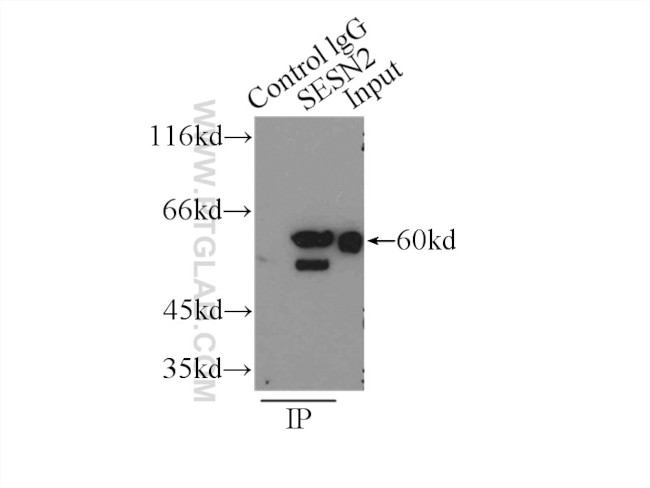 Sestrin 2 Antibody in Immunoprecipitation (IP)