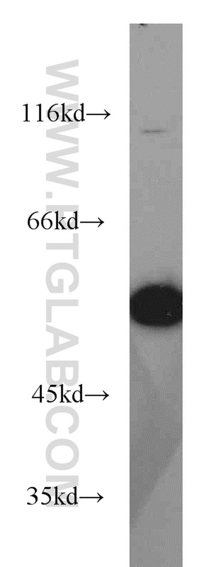 Sestrin 2 Antibody in Western Blot (WB)