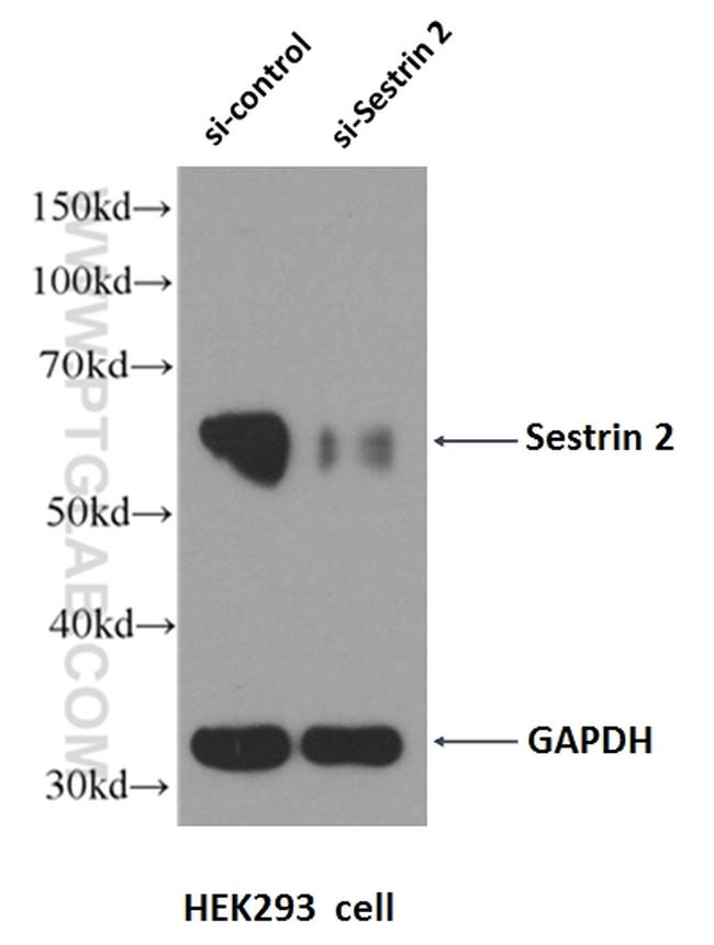 Sestrin 2 Antibody in Western Blot (WB)