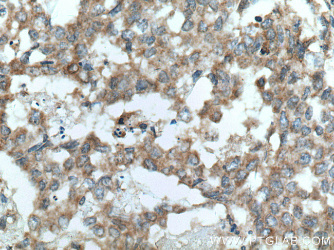 Sestrin 2 Antibody in Immunohistochemistry (Paraffin) (IHC (P))