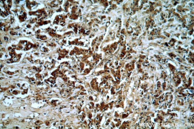 Sestrin 2 Antibody in Immunohistochemistry (Paraffin) (IHC (P))