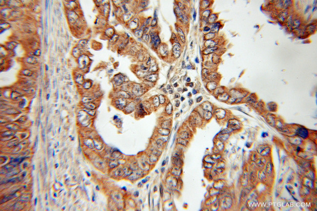 Sestrin 2 Antibody in Immunohistochemistry (Paraffin) (IHC (P))