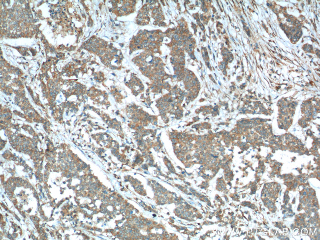 Sestrin 2 Antibody in Immunohistochemistry (Paraffin) (IHC (P))