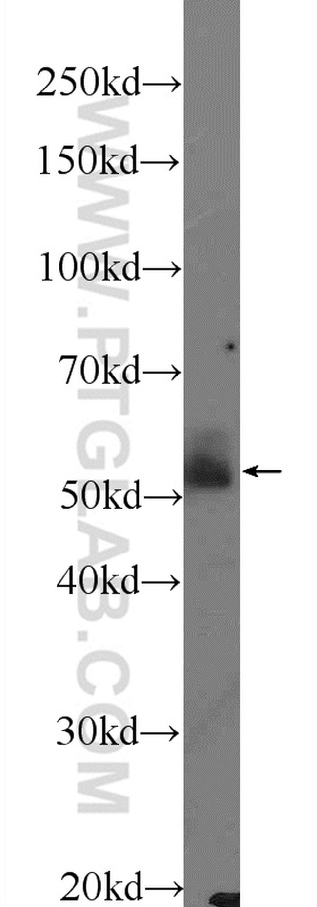 Sestrin 2 Antibody in Western Blot (WB)