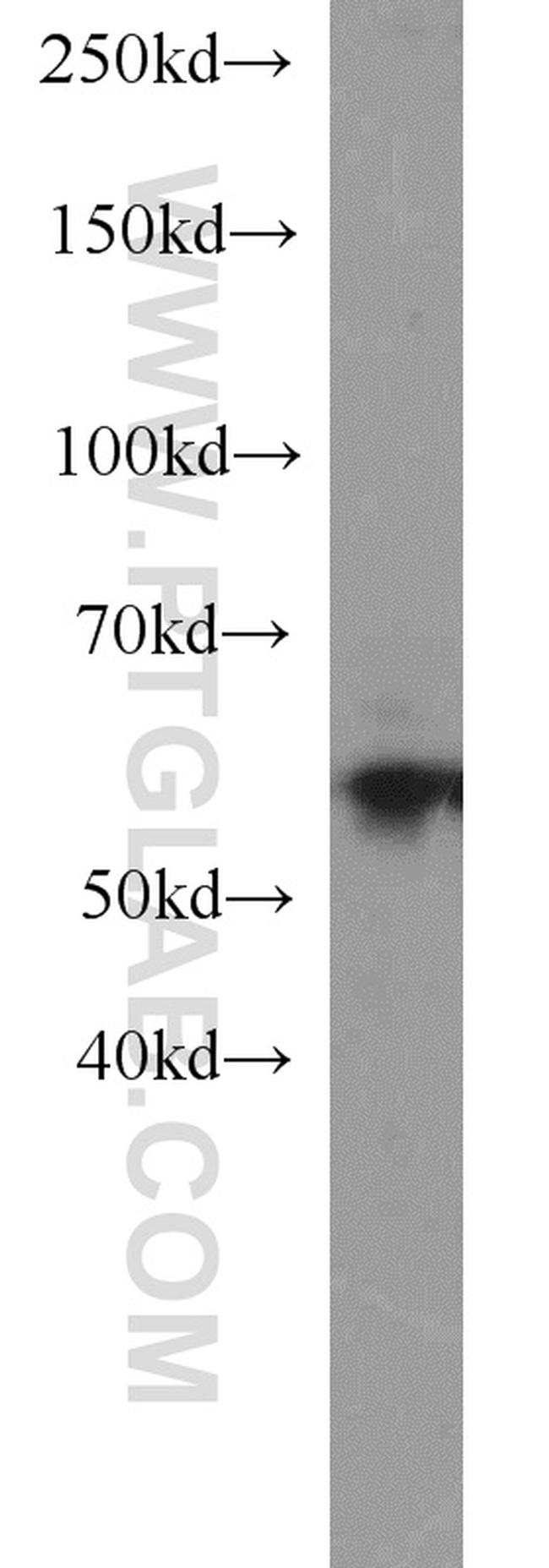 Sestrin 2 Antibody in Western Blot (WB)