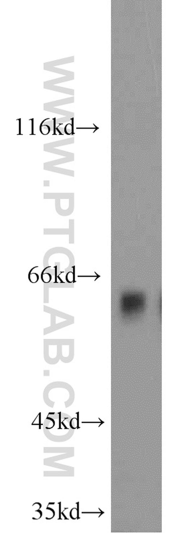 Sestrin 2 Antibody in Western Blot (WB)