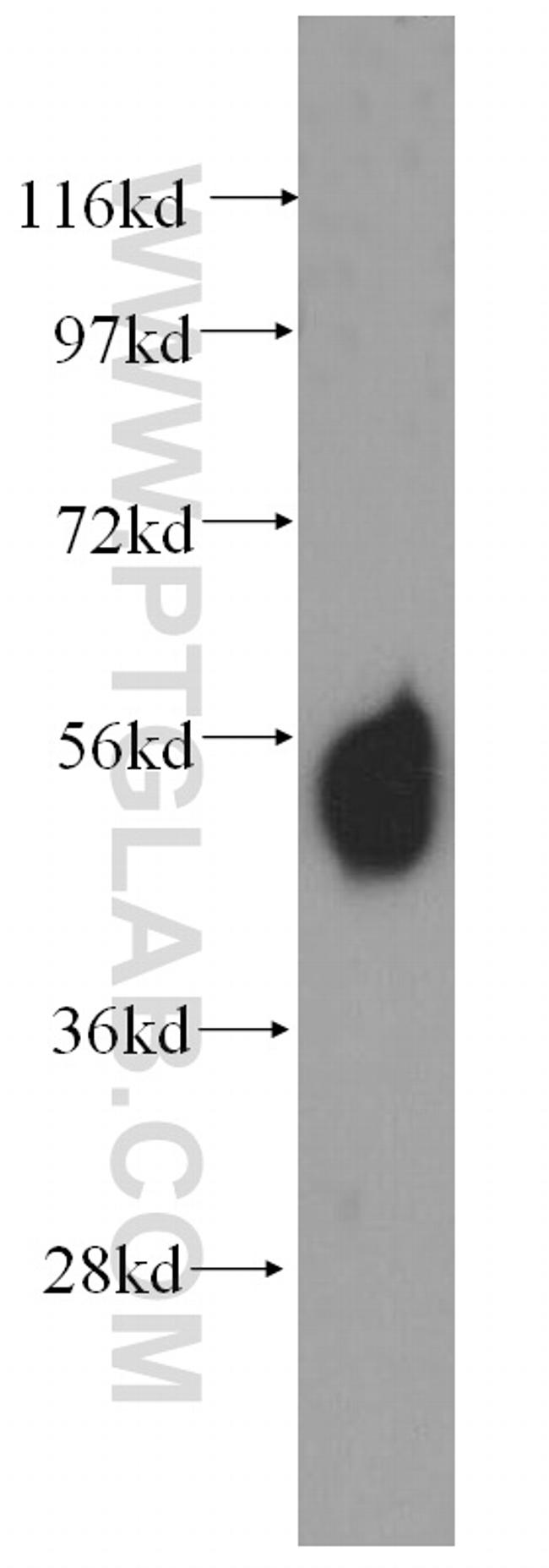 Sestrin 2 Antibody in Western Blot (WB)