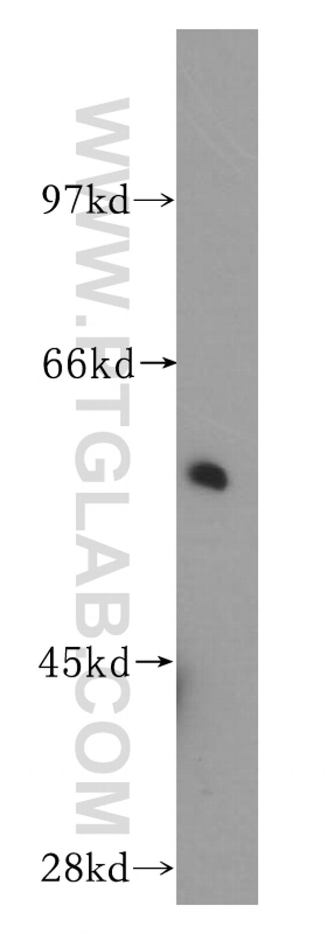 Sestrin 2 Antibody in Western Blot (WB)