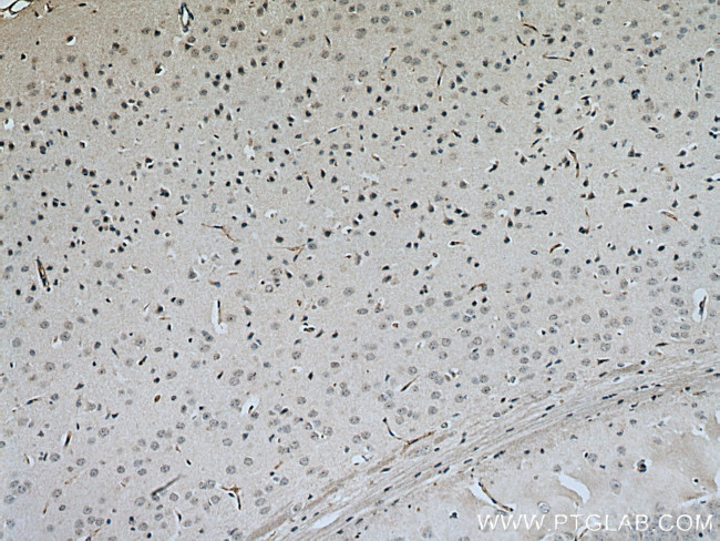 CNTFR Antibody in Immunohistochemistry (Paraffin) (IHC (P))