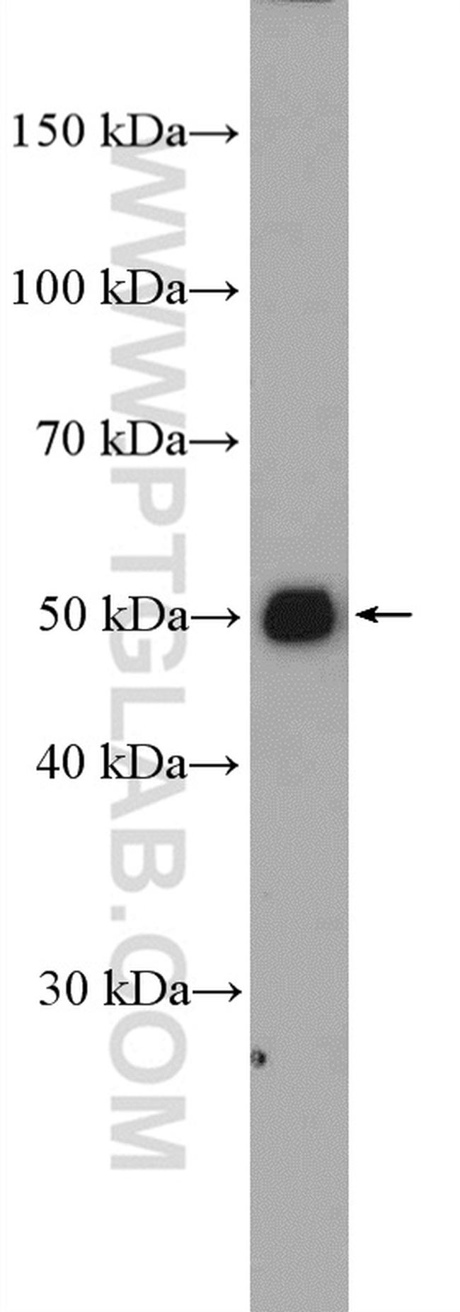 CNTFR Antibody in Western Blot (WB)