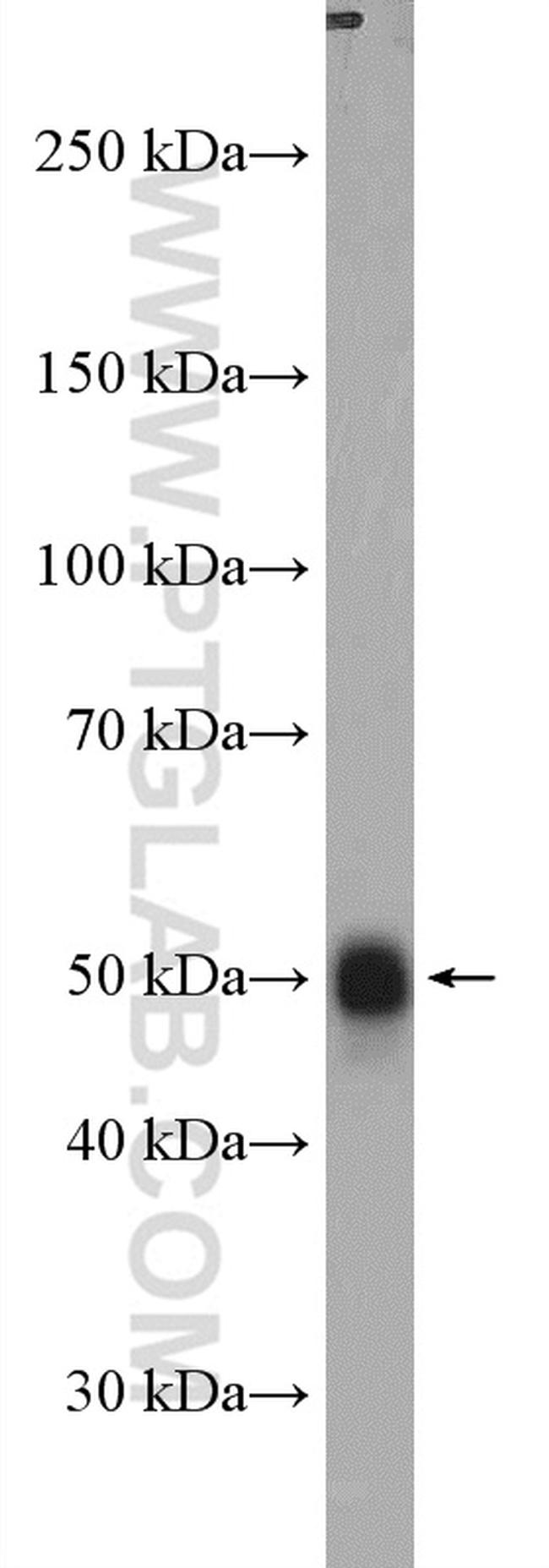 CNTFR Antibody in Western Blot (WB)