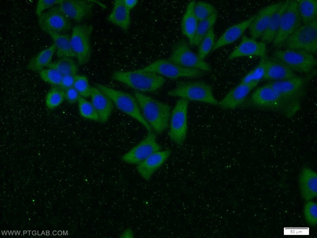 TRIP10 Antibody in Immunocytochemistry (ICC/IF)