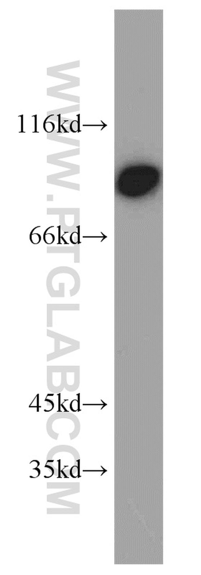 TRIP10 Antibody in Western Blot (WB)