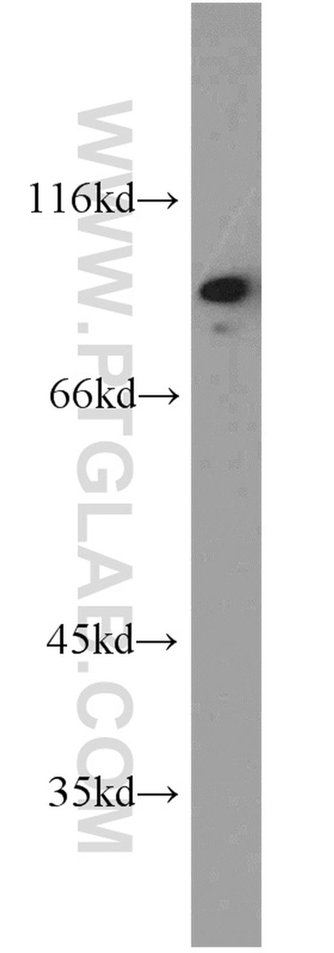 TRIP10 Antibody in Western Blot (WB)