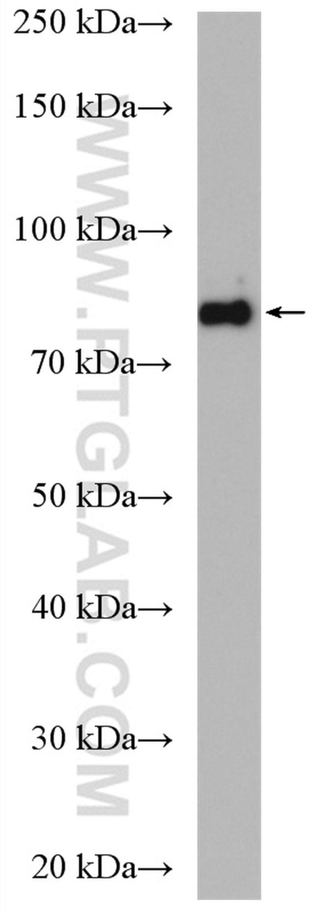 TRIP10 Antibody in Western Blot (WB)