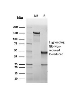 CFTR (Cystic Fibrosis Transmembrane Conductance Regulator) Antibody in SDS-PAGE (SDS-PAGE)