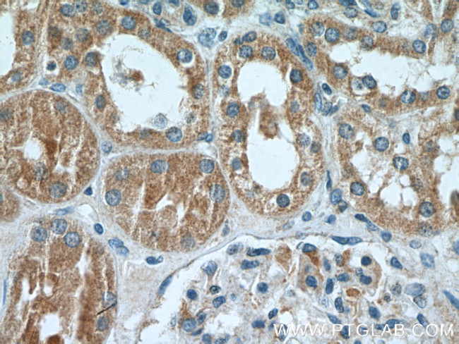 ARF3 Antibody in Immunohistochemistry (Paraffin) (IHC (P))